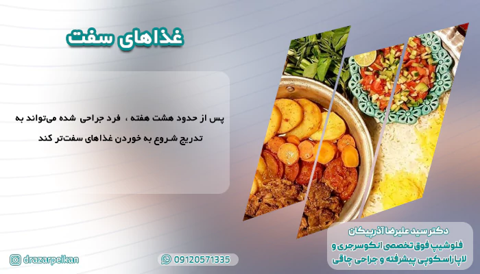 غذاهای مقوی بعد از عمل جراحی لاغری غذاهای سفت