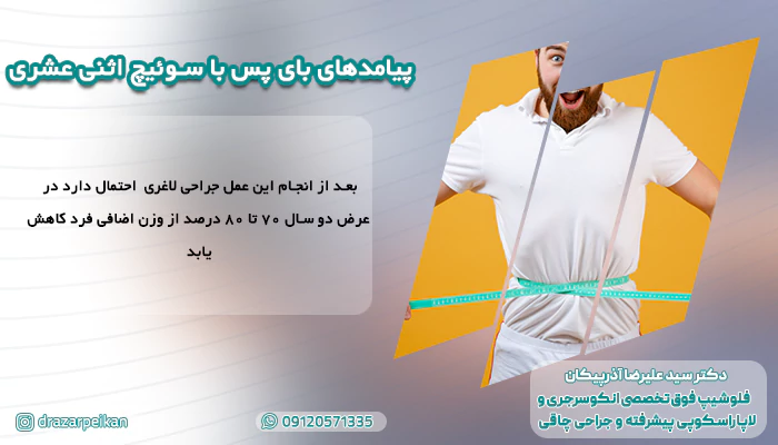 پیامدهای بای پس با سوئیچ اثنی عشری پیامدهای بای پس با سوئیچ اثنی عشری
