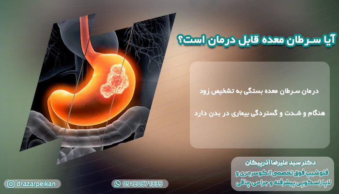 آیا سرطان معده قابل درمان است آیا سرطان معده قابل درمان است؟ کدام سرطان معده درمان دارد؟
