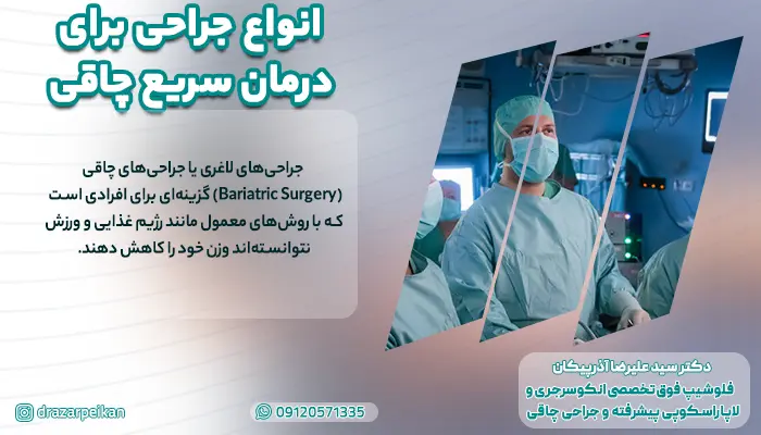 انواع جراحی برای درمان سریع چاقی