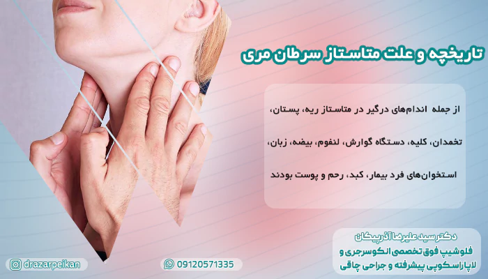 تاریخچه و علت متاستاز سرطان مری تاریخچه و علت متاستاز سرطان مری