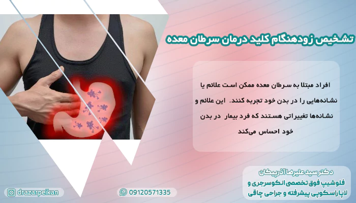 تشخیص زودهنگام کلید درمان سرطان معده علائم اولیه سرطان معده | 9 راه تشخیص علائم سرطان معده چیست؟