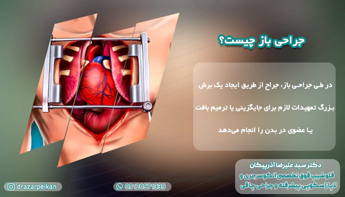 جراحی باز چیست؟ مقایسه لاپاراسکوپی و جراحی باز