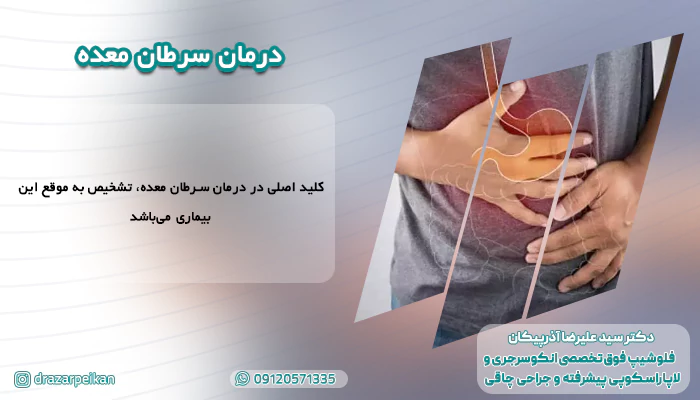درمان سرطان معده مواد غذایی و شیمیایی مناسب برای درمان سرطان معده