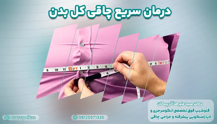 درمان سریع چاقی کل بدن