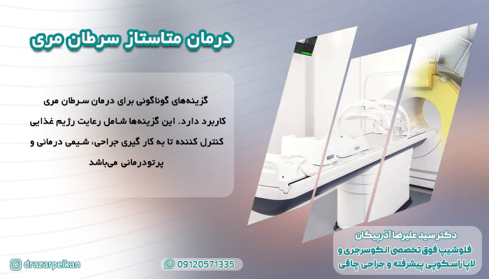 درمان متاستاز سرطان مری درمان متاستاز سرطان مری
