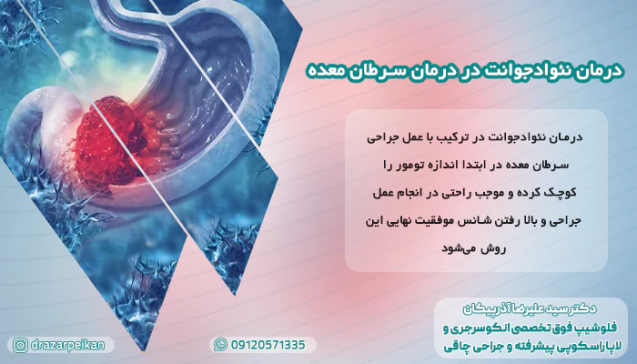 درمان سرطان معده با جراحی درمان نئوادجوانت در درمان سرطان معده