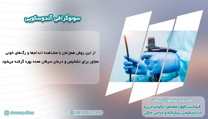 سونوگرافی آندوسکوپی سونوگرافی آندوسکوپی