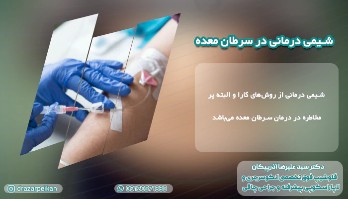 درمان سرطان معده با ترکیبی از شیمی درمانی و جراحی شیمی درمانی در سرطان معده