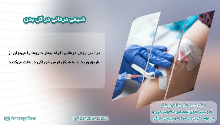 شیمی درمانی در کل بدن شیمی درمانی در کل بدن