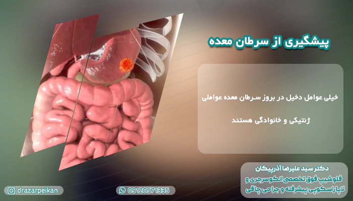 برای سرطان معده چی خوبه؟ پیشگیری از سرطان معده