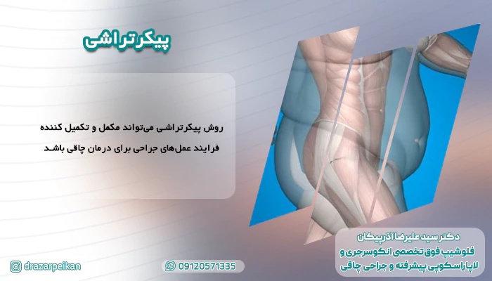 پیکرتراشی دکتر آذرپیکان