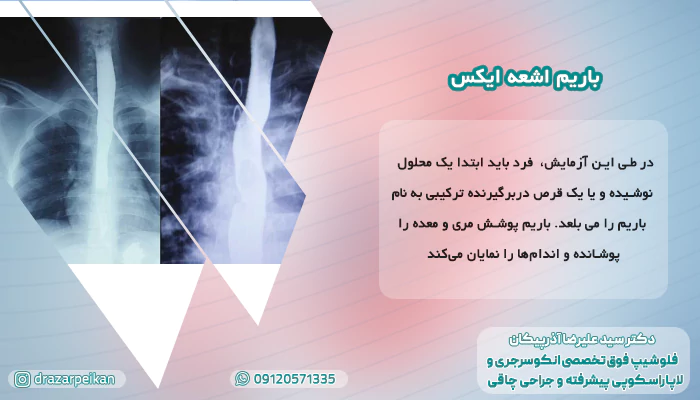 باریم اشعه ایکس باریم اشعه ایکس