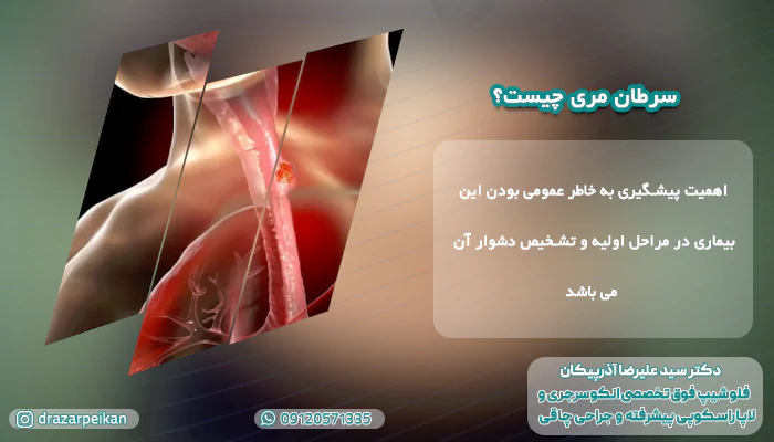 درمان سرطان مری با طب سنتی سرطان مری چیست
