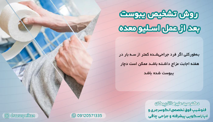 روش تشخیص یبوست روش تشخیص یبوست بعد از عمل اسلیو معده در بیماران