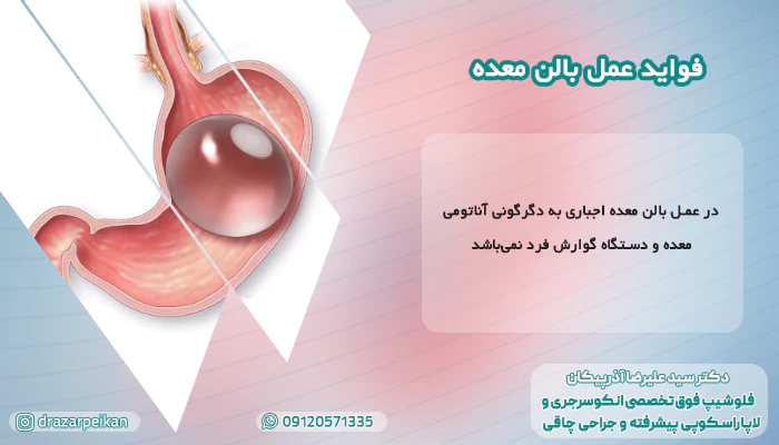 فواید عمل بالن معده فواید عمل بالن معده