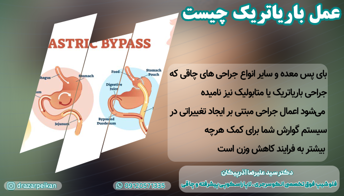 هزینه عمل باریاتریک باریاتریک