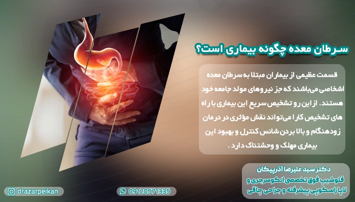 تشخیص سرطان معده سرطان معده چگونه بیماری است