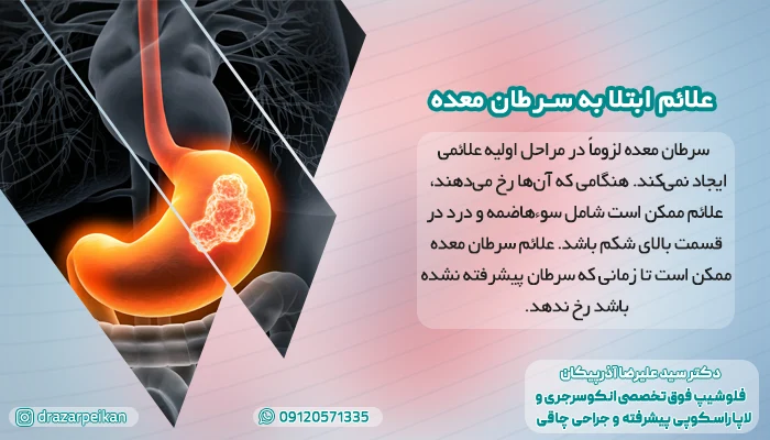 علائم ابتلا به سرطان معده علائم ابتلا به سرطان معده