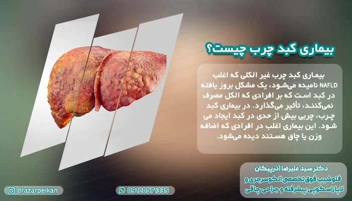 بیماری کبد چرب چیست