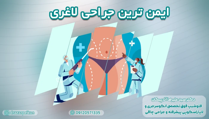 ایمن ترین عمل لاغری