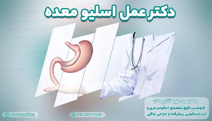 دکتر عمل اسلیو معده