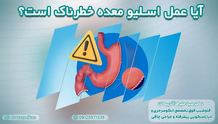 خطرات و فواید عمل اسلیو معده کدام اند؟