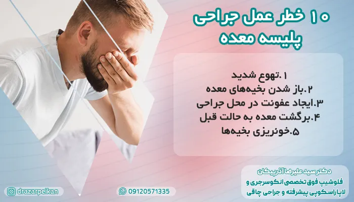 10 خطر جدی در عمل پلیسه معده را بشناسید