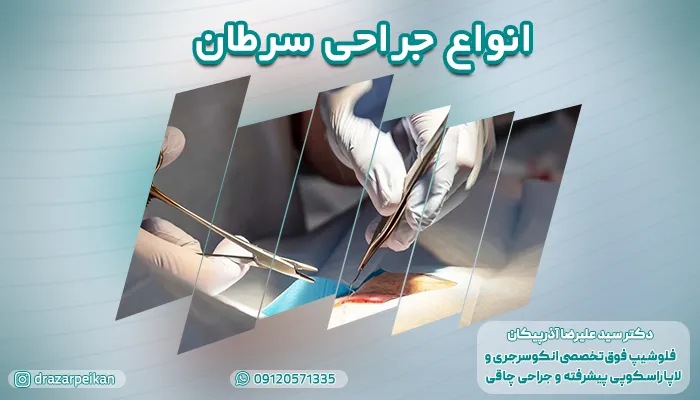 انواع جراحی سرطان را بشناسید و بهترین روش جراحی سرطان را برای درمان انتخاب کنید