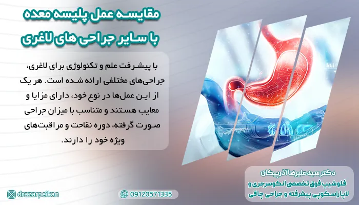 مقایسه جراحی پلیسه معده با سایر جراحی های لاغری