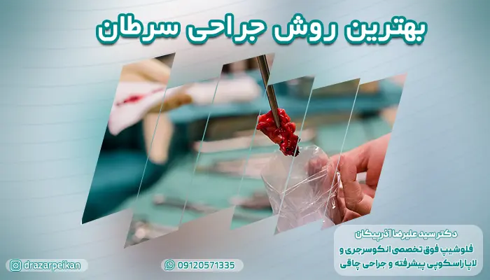 بهترین جراحی سرطان و بهترین روش برای انجام جراحی سرطان