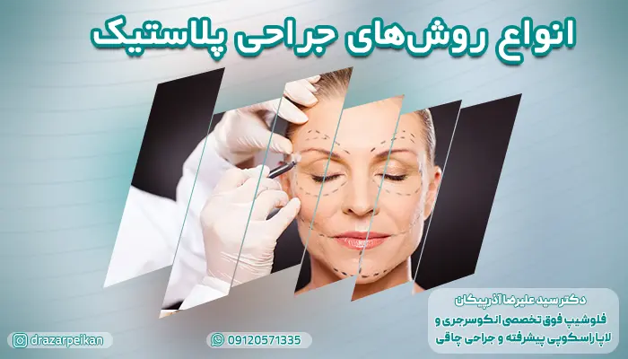 آشنایی با انواع روش های جراحی پلاستیک در کلینیک دکتر آذرپیکان