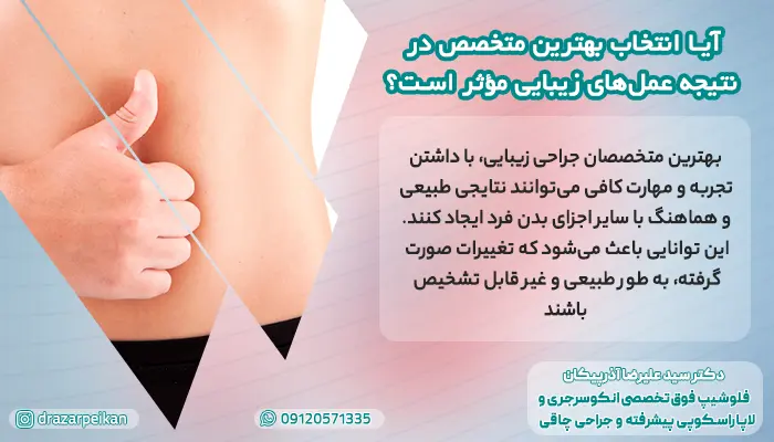 تاثیر انتخاب بهترین متخصص جراحی زیبایی در تهران
