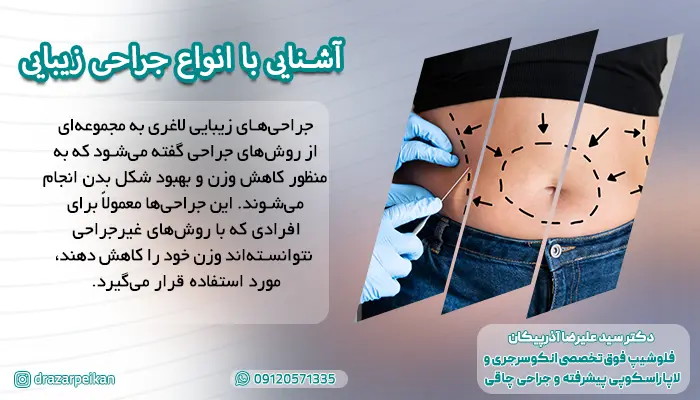 معرفی و آشنایی با انواع جراحی زیبایی
