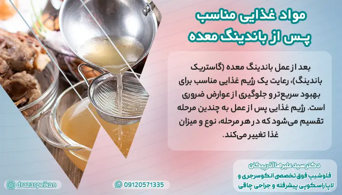 بعد از عمل باندینگ معده خوردن چه غذاهایی مشکلی ندارد؟