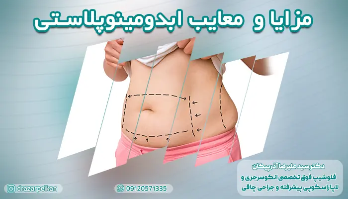 مزایا و معایب ابدومینوپلاستی | عوارض ابدومینوپلاستی چیست؟