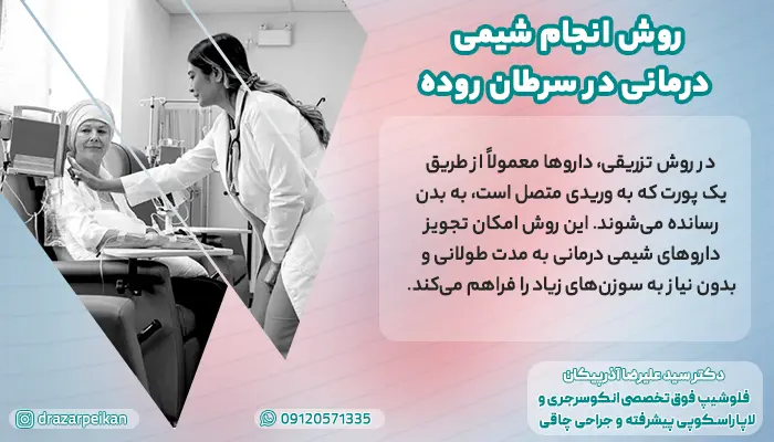 روش انجام شیمی درمانی در بیماران مبتلا به سرطان روده