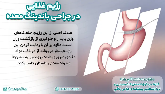 بهترین مواد غذایی برای رژیم غذایی بعد از باندینگ معده