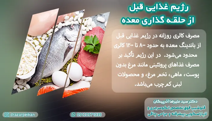 مناسب ترین رژیم غذایی برای قبل از باندینگ معده