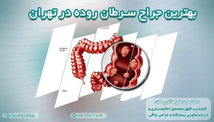 بهترین متخصص جراحی سرطان روده در تهران