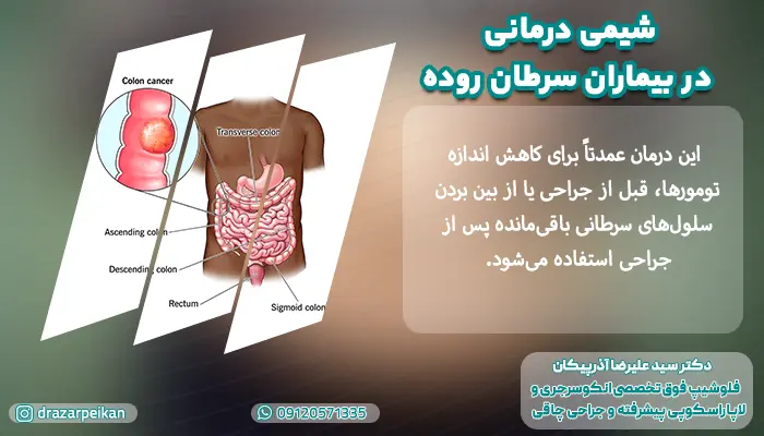 شیمی درمانی در بیماران سرطان روده چگونه انجام می شود؟