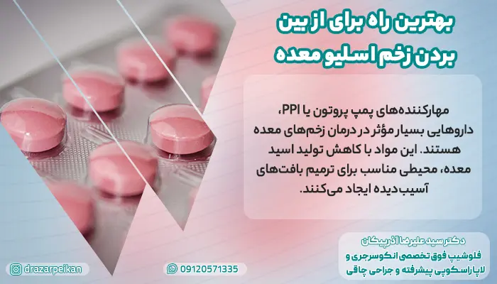 بهترین راه برای از بین بردن زخم اسلیو معده