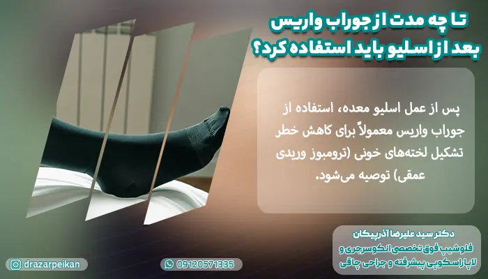 تا چه مدت بعد از اسلیو باید از جوراب واریس استفاده کرد؟