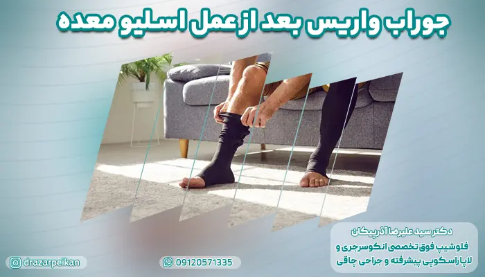 جوراب واریس بعد از عمل اسلیو معده