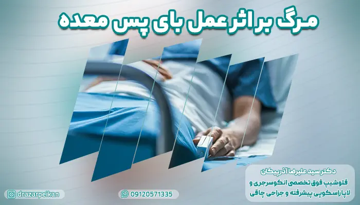 آیا مرگ بر اثر عمل بای پس معده واقعیت دارد؟