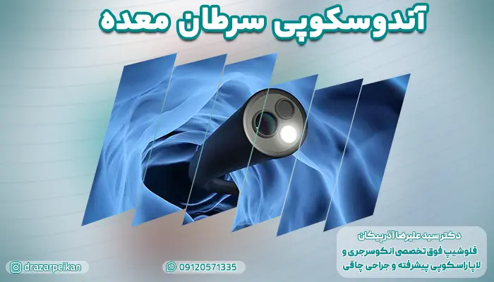 آندوسکوپی در سرطان معده | انواع، مزایا و معایب آندوسکوپی سرطان معده