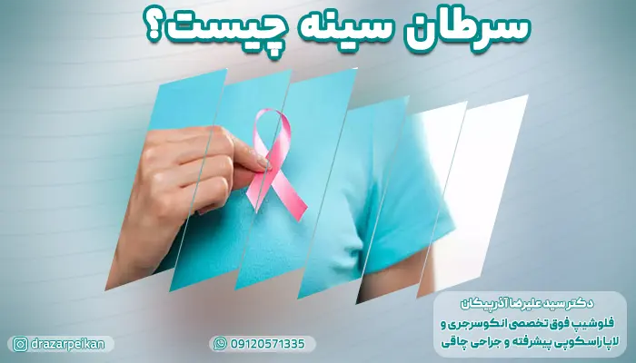 سرطان سینه چیست؟ آشنایی با سرطان پستان