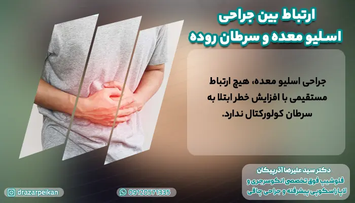 ارتباط بین جراحی اسلیو معده و سرطان روده