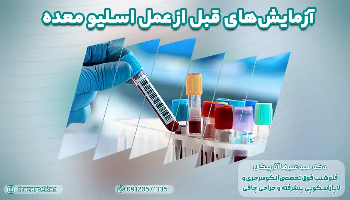 آزمایشات قبل از اسلیو معده