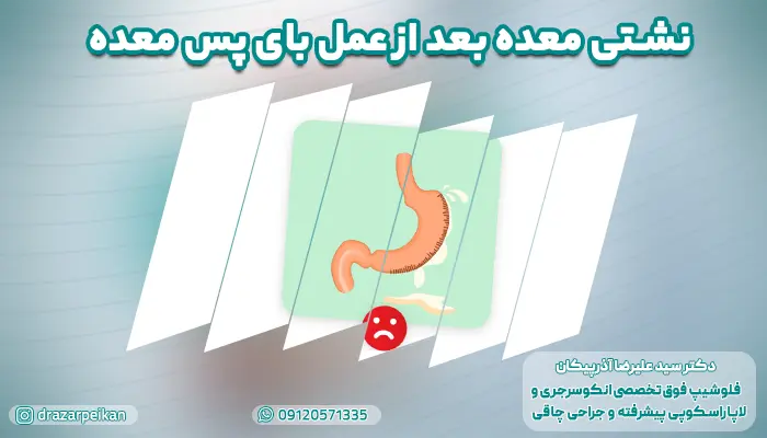 نشتی معده بعد از عمل بای پس معده